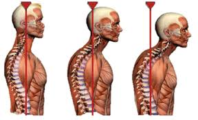 peso testa cervicalgia